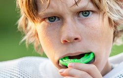 wisdom-teeth-extraction