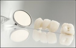tooth-extraction
